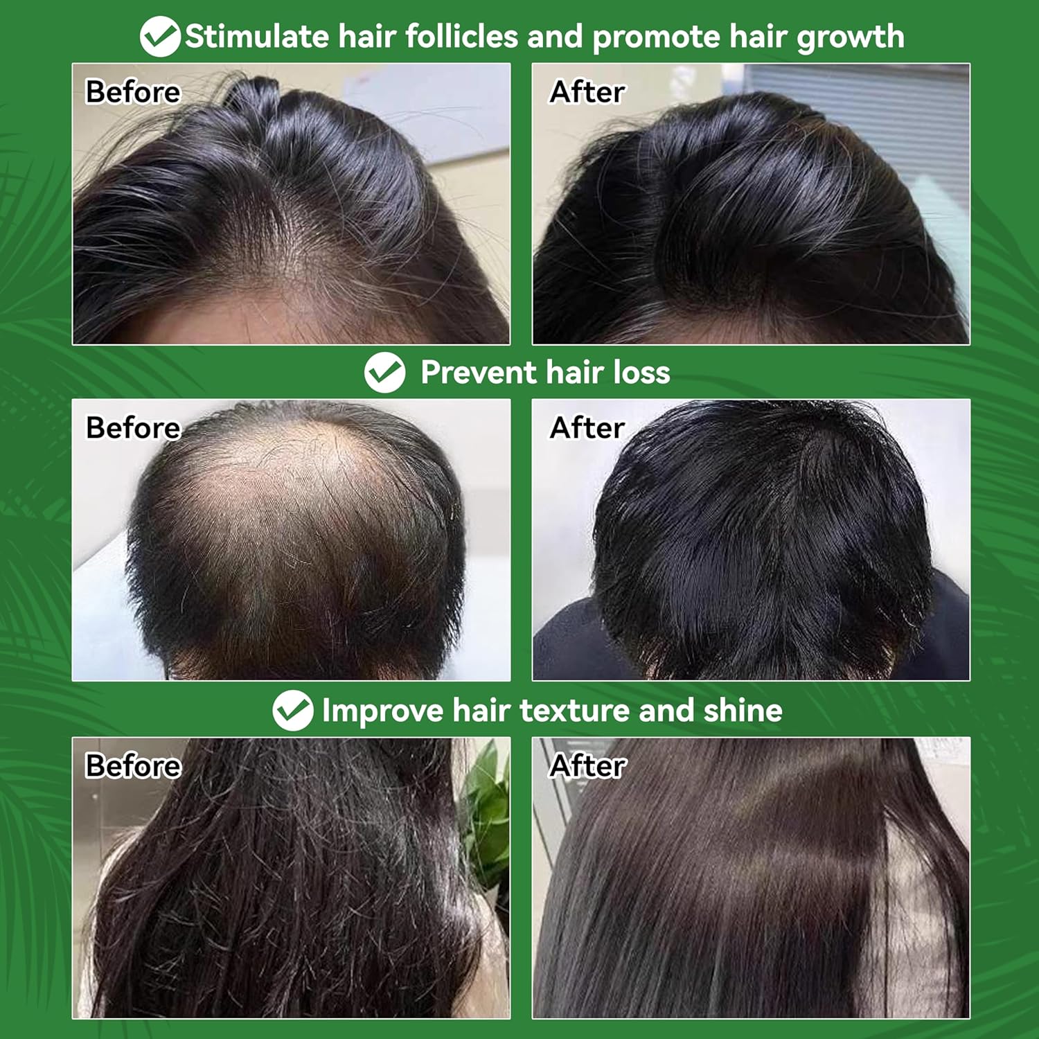 WTEGIGA 100% Natural Batana Oil